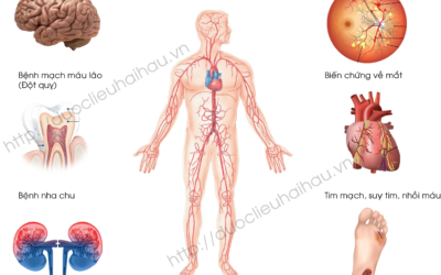 Bệnh tiểu đường – Nguyên nhân, triệu chứng và cách điều trị hiệu quả.